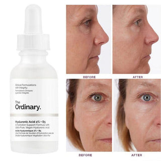 The Ordinary Hyaluronic Acid with 2% + B5 (30ml)