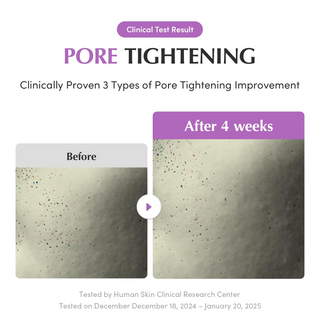 before and after 4 weeks comparision of pore tightening