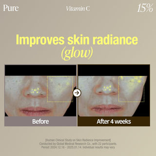 Goodal Green Tangerine Vita C 15 Dark Spot Care Ampoule 16g.