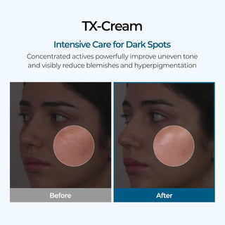 Dr. Melaxin TX Cream 50g