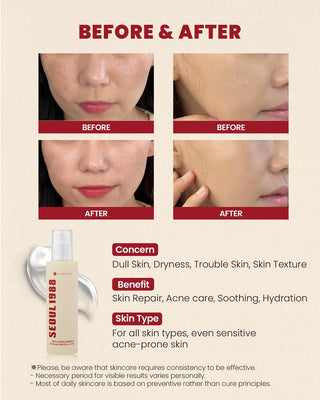 K-SECRET SEOUL1988 Essence : Snail Mucin 97% + Rice 100 ml/3.38 floz.
