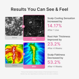 Medicube Rosemary PDRN Hair & Scalp Serum