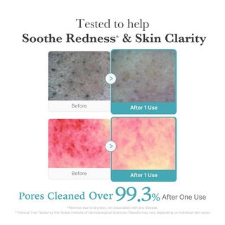 medicube Azelaic Acid And Niacinamide Deep Clean Foam Cleanser 120g