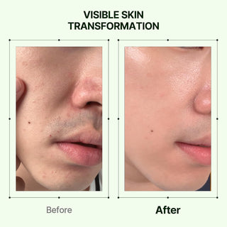Orien Mugwort and Collagen Pore Serum 30ml Korean facial serum for visible pore care, hydration, smoother texture and firmer-looking skin in UAE.