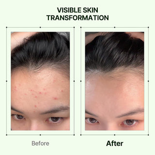 Orien Mugwort Zero Film Toner 160ml lightweight Korean facial toner for refreshing hydration and comfortable skin preparation in UAE.