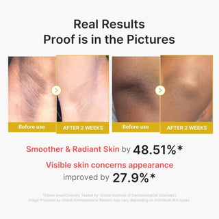 medicube - Kojic Acid Turmeric Body Peel Shot - 280ml