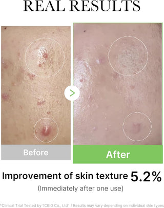 medicube Exosome Cica Tea Tree Ampoule 30ml