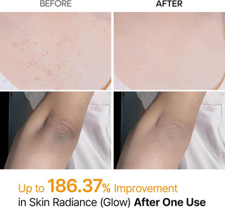 Dr. Melaxin Kojic Acid Turmeric Body Spray 200mL