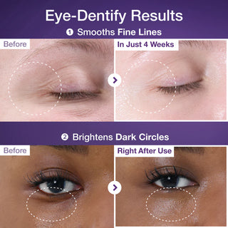 Numbuzin No.9 3 Days Eye Care Kit | Intensive Firming & Wrinkle Care for Eyes