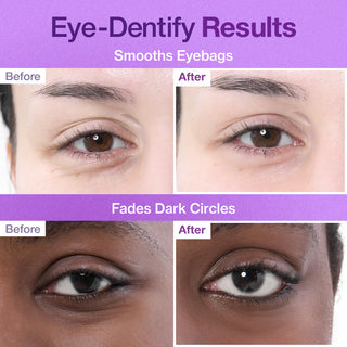 Numbuzin No.9 3 Days Eye Care Kit | Intensive Firming & Wrinkle Care for Eyes