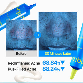 Numbuzin No.0 Zero Blemish 3X Spot Correcting Cream 20ml with 5% Azelaic Acid, 10% Niacinamide and Colloidal Sulfur for blemishes, excess sebum and post-acne marks in UAE.