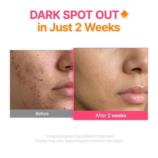 PURITO SEOUL TXA 6 Niacinamide 10 Retinal Serum 30ml Korean brightening serum with 6% Tranexamic Acid, 10% Niacinamide, Retinal and Glutathione for dark spots and post-acne marks in UAE.