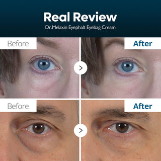 Dr. Melaxin Eyephalt EP Eyebag Cream 10g